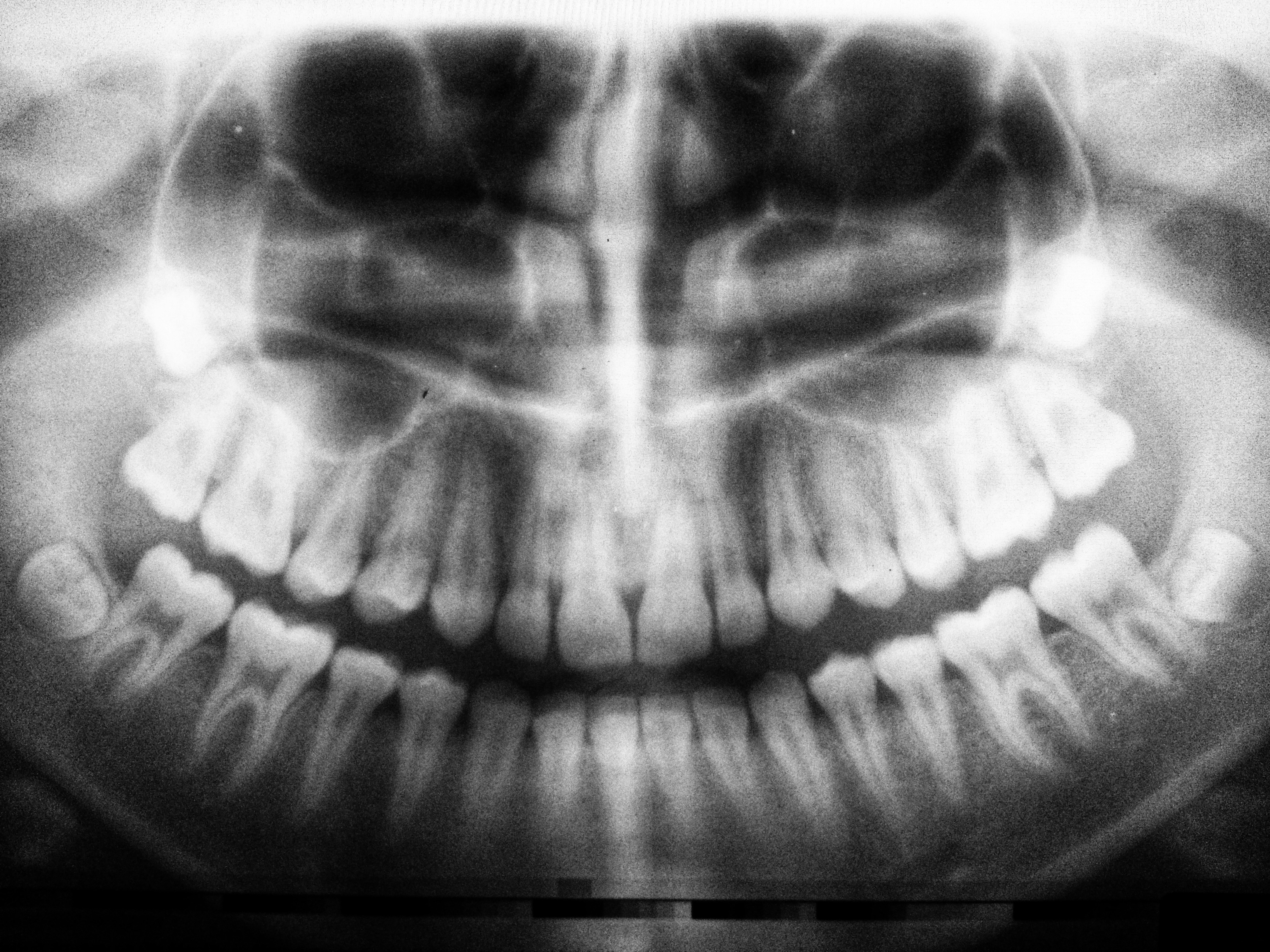 Dental